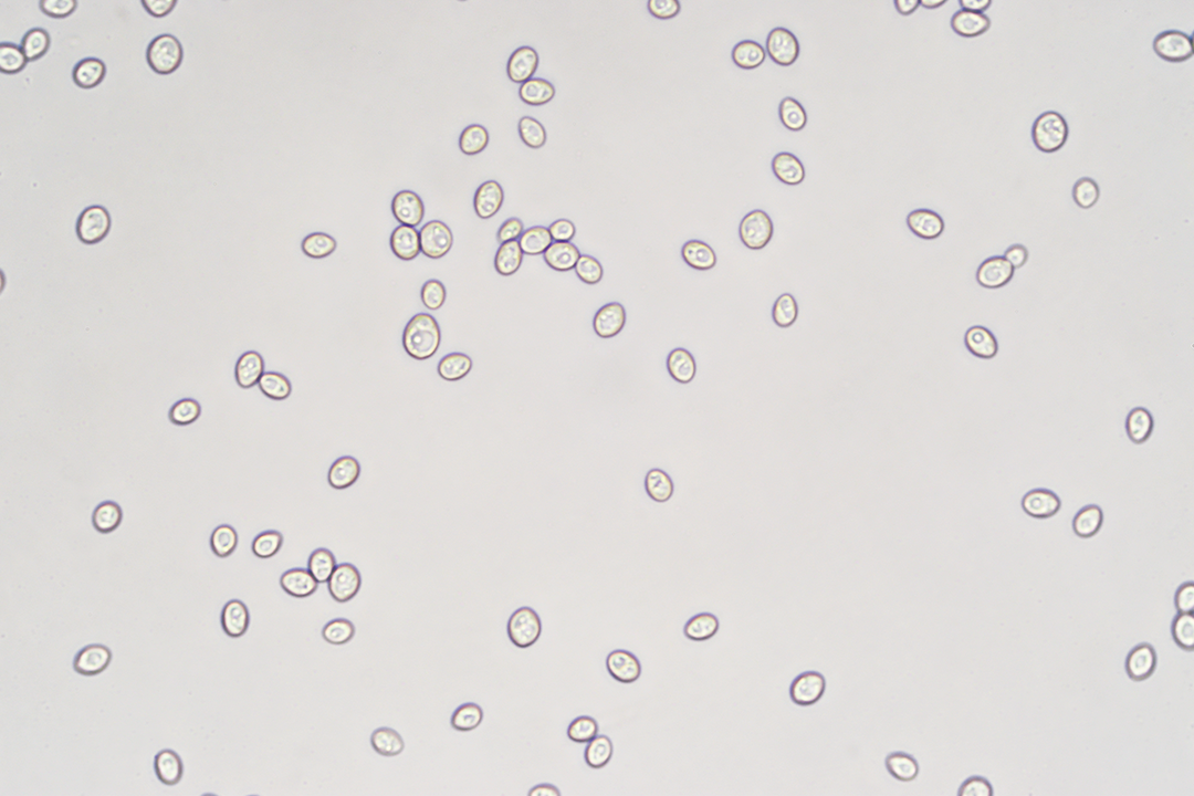 The Life of a Yeast Cell